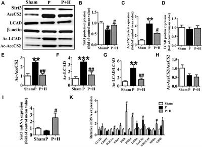 Honokiol Inhibits Atrial Metabolic Remodeling in Atrial Fibrillation Through Sirt3 Pathway